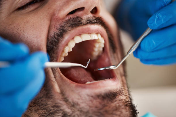 Best Full Mouth Reconstruction  in Kernersville, NC